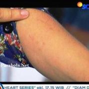 Gigitan Aliando pada Tangan Prilly Latuconsina