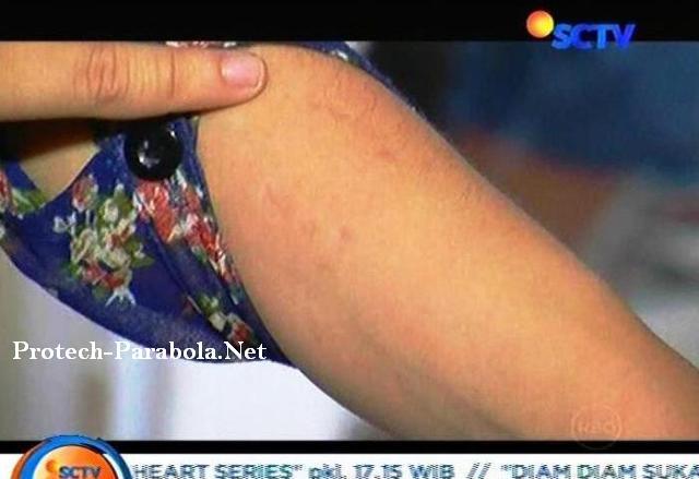 Gigitan Aliando pada Tangan Prilly Latuconsina